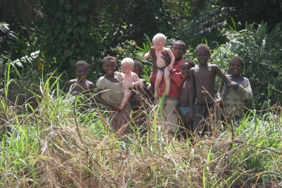 Albino twins (file photo).