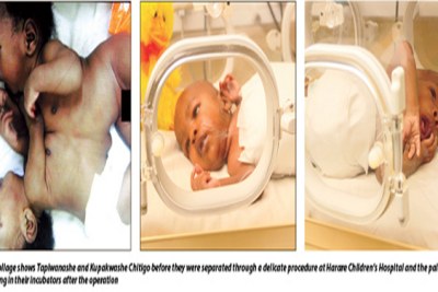 This collage shows Tapiwanashe and Kupakashwe before they were separated through a delicate procedure at Harare Children's Hospital and the pair recuperating in their incubators after the operation.