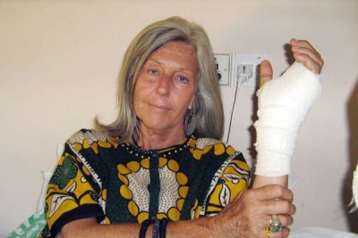 Conservationist Kuki Gallmann shows the arm which was fractured after illegal grazers invaded her Laikipia Nature Conservancy ranch (file photo).