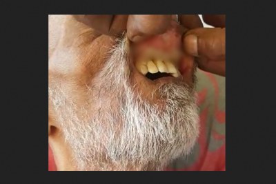 Screenshot: A Durban man cleans maggots out of his father's mouth after hospital staff refused to help.