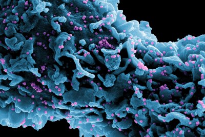 A colorized scanning electron micrograph of a cell (blue) infected with a variant strain of SARS-CoV-2 virus particles (UK B.1.1.7; purple). (file photo).