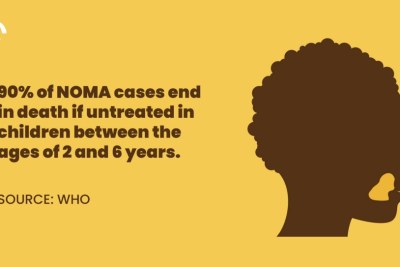 Noma is a preventable and treatable disease that affects people living in poverty, especially young children, and is associated with malnutrition and unsanitary living conditions.