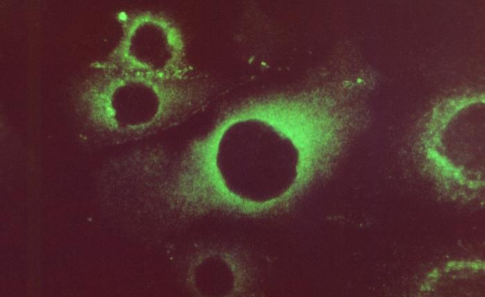 South Africa: Health Department Warns of Rise of Rubella - South African News Briefs - December 20, 2024
